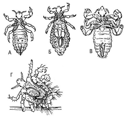 Виды вшей с картинками