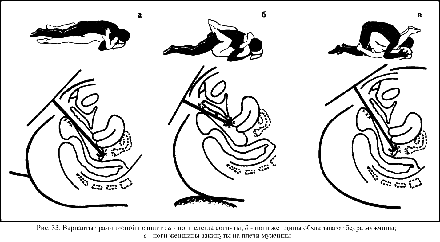 Схема движения члена в вагине в разных позах